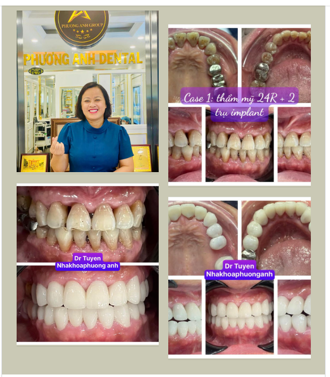 Nụ cười tỏa sáng thế này bác sĩ có xứng đáng được thả tim không ạ