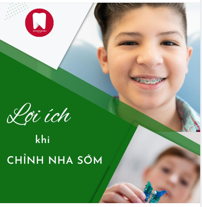 LỢI ÍCH KHI CHỈNH NHA SỚM