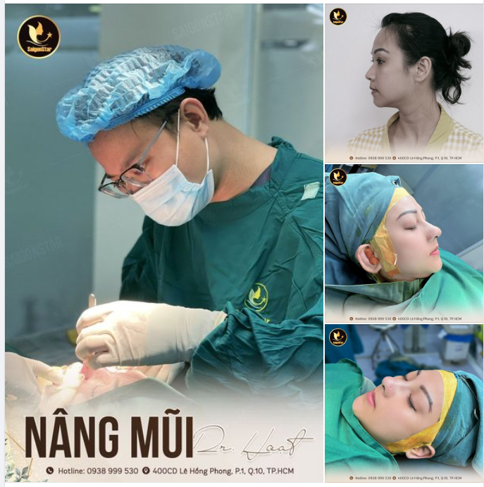 ALANA XINH NHƯ HOT GIRL SAU 60 PHÚT NÂNG MŨI DR. HOẠT