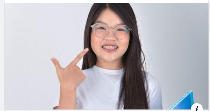 NIỀNG RĂNG TRƯỚC KHI ĐI DU HỌC - KHOẢN ĐẦU TƯ THÔNG MINH