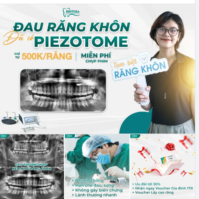 ĐAU RĂNG KHÔN ĐÃ CÓ PIEZOTOME LO
