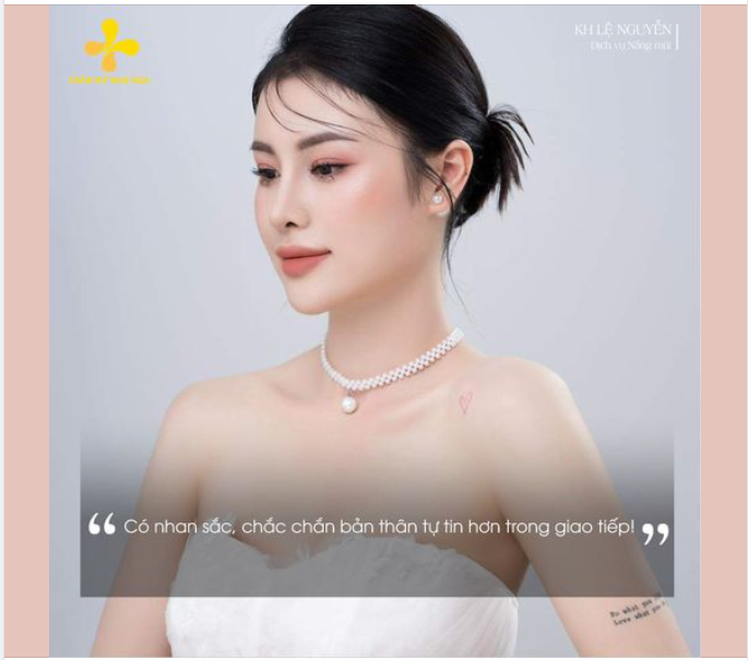 Đây là khách hàng Lệ Nguyễn nâng mũi sụn Mỹ bọc sụn tai tại Tiến sĩ thẩm mỹ, bác sĩ Tống Hải - Thẩm mỹ Như Hoa: