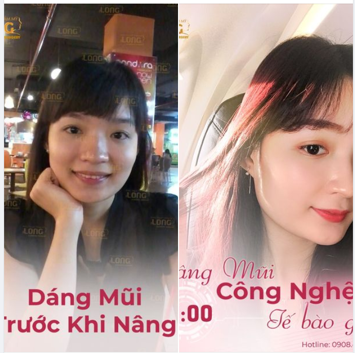 LÀM ĐẸP CỰC XINH, LUNG LINH ĐÓN LỄ