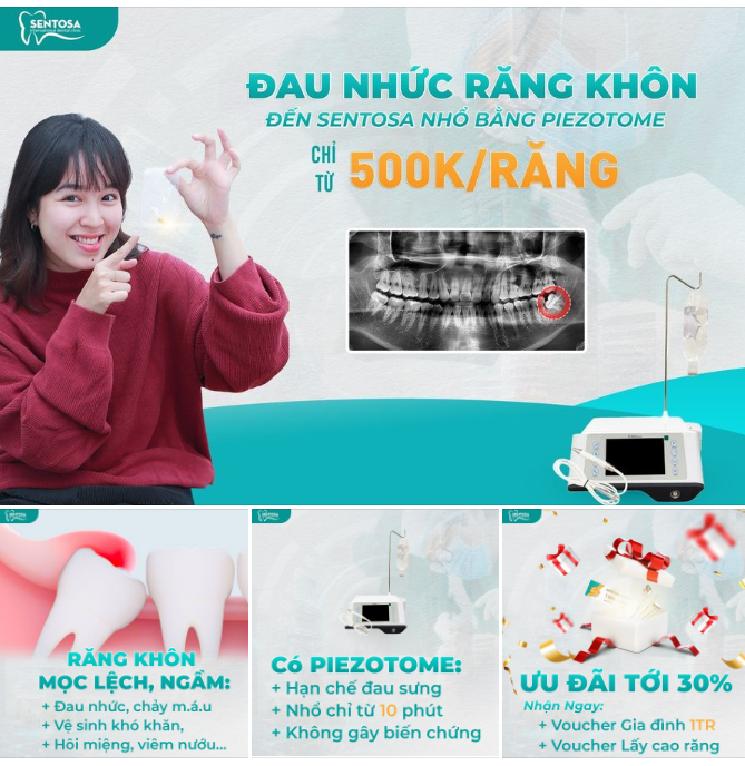 ĐAU NHỨC RĂNG KHÔN ​​​​​​​ ĐẾN SENTOSA NHỔ BẰNG PIEZOTOME CHỈ TỪ 500K/RĂNG