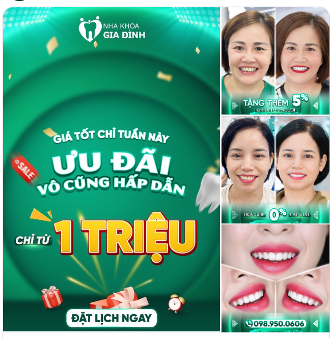 THẨM MỸ RĂNG SỨ GIÁ TỐT DÀNH CHO 20 KHÁCH HÀNG ĐĂNG KÝ SỚM NHẤT