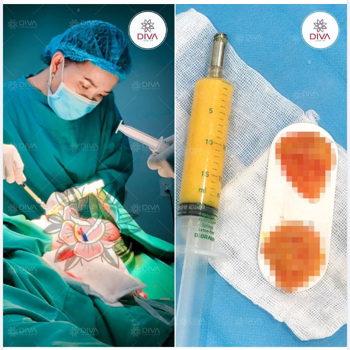 COMBO THẨM MỸ GIÚP GƯƠNG MẶT TRẺ TRUNG, HÀI HÒA HƠN?