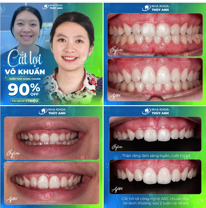 CƯỜI HỞ LỢI TRONG TƯỚNG SỐ