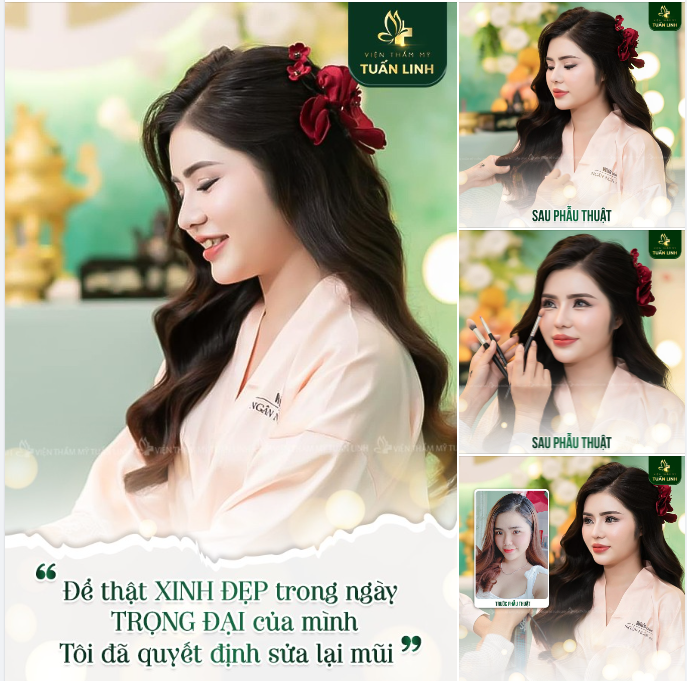 Có MŨI CAO- Tự tin ''biến hình'' thành nàng dâu CỰC PHẨM!!