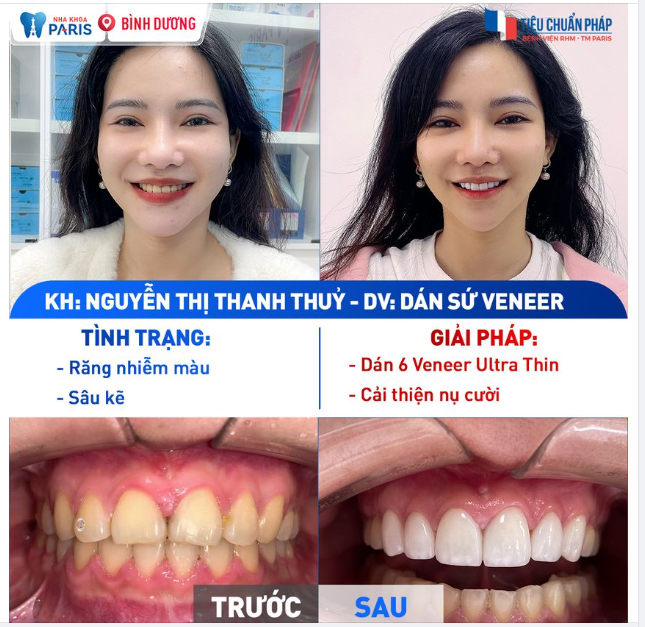 Làm gì khi bạn không hài lòng với nụ cười của bản thân?