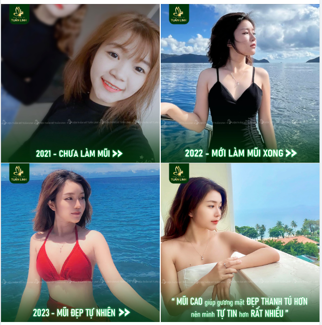Chiếc mũi quyết định 70% nhan sắn gương mặt