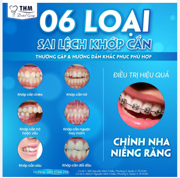6 DẠNG SAI LỆCH KHỚP CẮN VÀ HƯỚNG KHẮC PHỤC HIỆU QUẢ