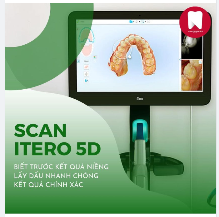 MÁY SCAN RĂNG 5D ITERO - BƯỚC ĐỘT PHÁ TRONG NGÀNH CHỈNH NHA