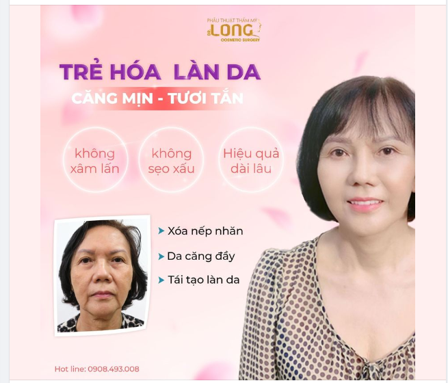 THÁNG 8 TỚI NHIỀU ƯU ĐÃI LÀM ĐẸP MỚI CĂNG DA CHỈ TỪ 30 TRIỆU đang diễn ra chỉ có 10 suất duy nhất