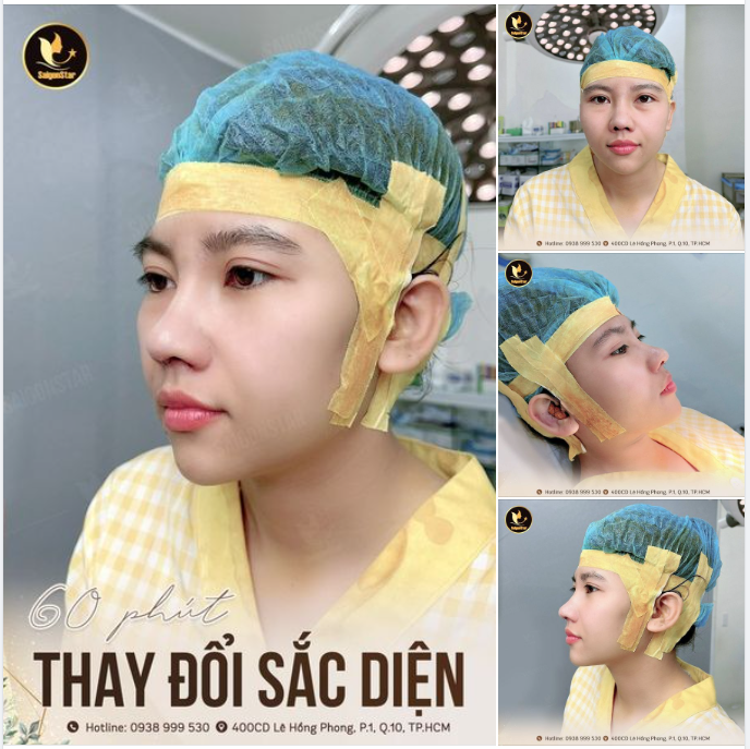 60 PHÚT THAY ĐỔI SẮC DIỆN ƯU ĐÃI 50%  MIỄN PHÍ CHỤP CT 3D
