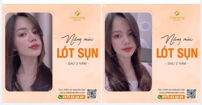 Gọi em là ngã rẽ... vì gặp em anh phải cuaaa
