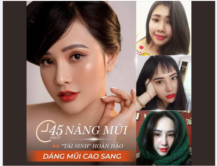 "TÁI SINH" HOÀN HẢO - DÁNG MŨI CAO SANG
