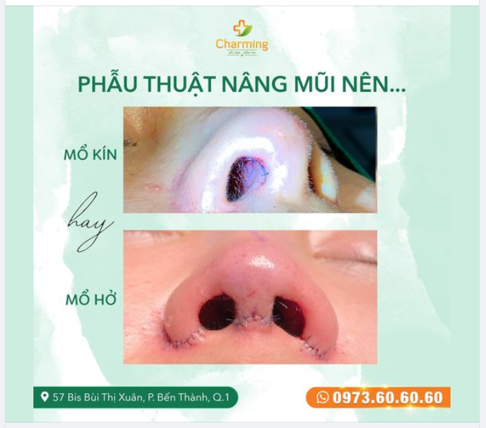 MỔ KÍN HAY MỔ HỞ - LỰA CHỌN PHÙ HỢP CHO MỖI TRƯỜNG HỢP