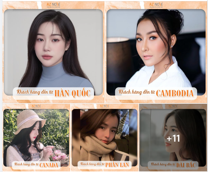 KH ở nước ngoài và các du học sinh tin chọn nâng mũi tại AZ NOSE vì điều gì
