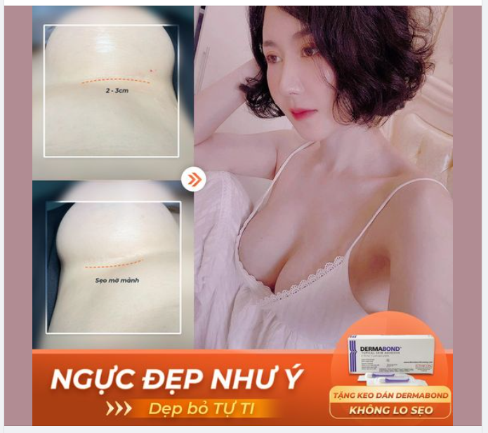NGỰC ĐẸP NHƯ Ý - DẸP BỎ TỰ TI