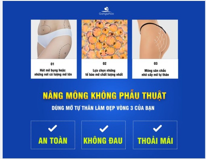 CẤY MỠ TỰ THÂN CHO VÒNG 3 TRÒN ĐẦY