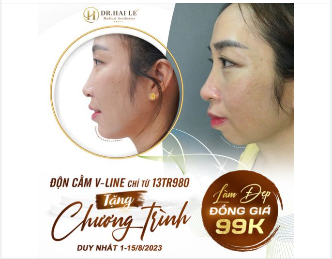 Nhân tướng học phương Đông nói rằng, người sở hữu tướng cằm ngắn, lẹm… thường không có sự quyết đoán, hay phụ thuộc vào người khác, cuộc sống khó khăn..