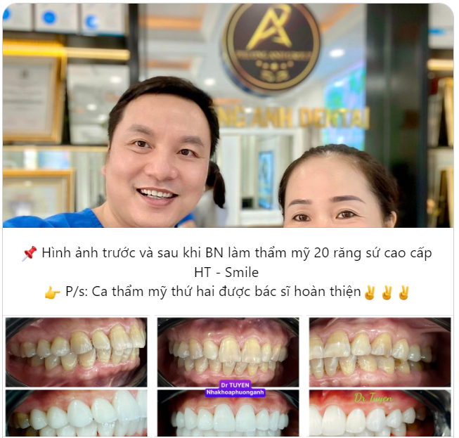 CA THẨM MỸ THỨ 2 ĐƯỢC BÁC SĨ THỰC HIỆN