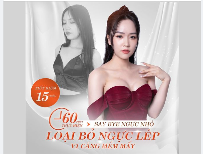 THOÁT LÉP DỄ DÀNG - V1 CĂNG TRÀN CHUẨN Y KHOA
