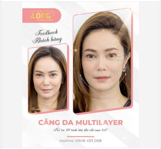 TRẺ HÓA DA TOÀN NĂNG - VẾT NHĂN LỚN NHỎ ĐỀU BIẾN MẤT