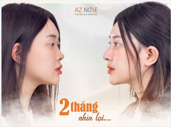 “Nếu trước đây mình chỉ dám lấy đúng 1 góc mặt mỗi khi chụp ảnh hay quay MV thì bây giờ mình đã có thể tự tin ở bất kỳ góc nào. Trộm vía nhờ thế mà mình đắt show hơn nữa đó”,