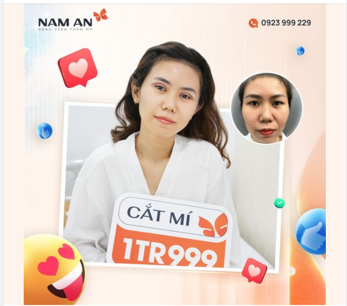 MẮT ĐẸP TO TRÒN LONG LANH NHỜ CẮT MÍ TRÊN