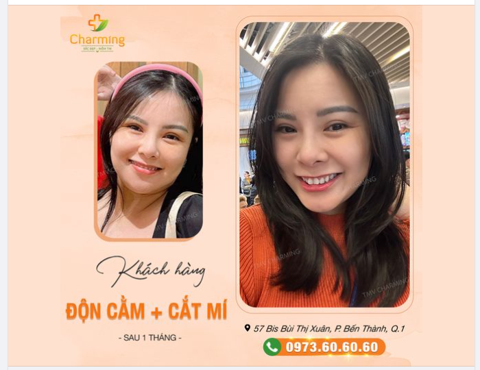 Bạn có tin chỉ cần 1 tháng là đã có thể nâng cấp vẻ đẹp, cải thiện bề ngoài ngày càng rạng rời hay không?