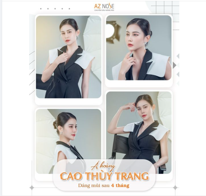 Thần thái "bén ngót" của Á hoàng CaoThùyTrang sau 4 tháng tái tạo dáng mũi