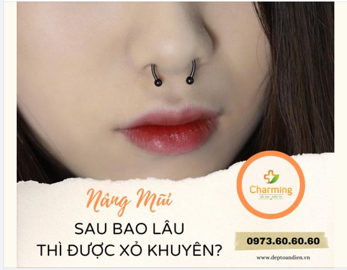 SAU PHẪU THUẬT NÂNG MŨI BAO LÂU THÌ ĐƯỢC XỎ KHUYÊN?