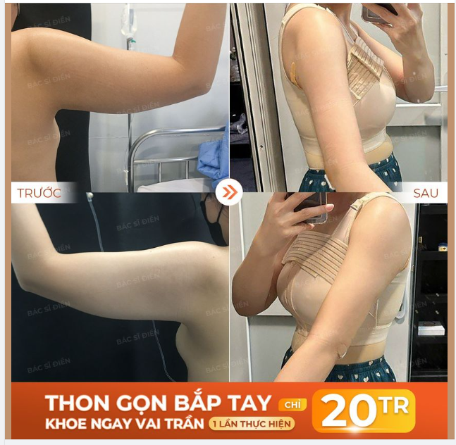 THON GỌN BẮP TAY - KHOE NGAY VAI TRẦN