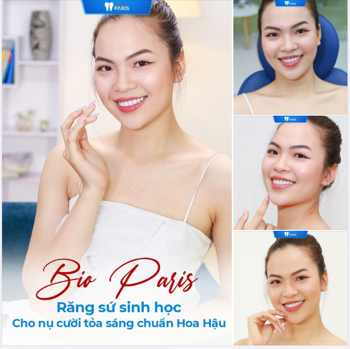 Giờ đây, sau khi làm răng sứ sinh học Bio Paris, Như Quỳnh đã tự tin cười tươi cũng như tự tin sải bước trên cả sàn catwalk và thả dáng trong những shoot hình.