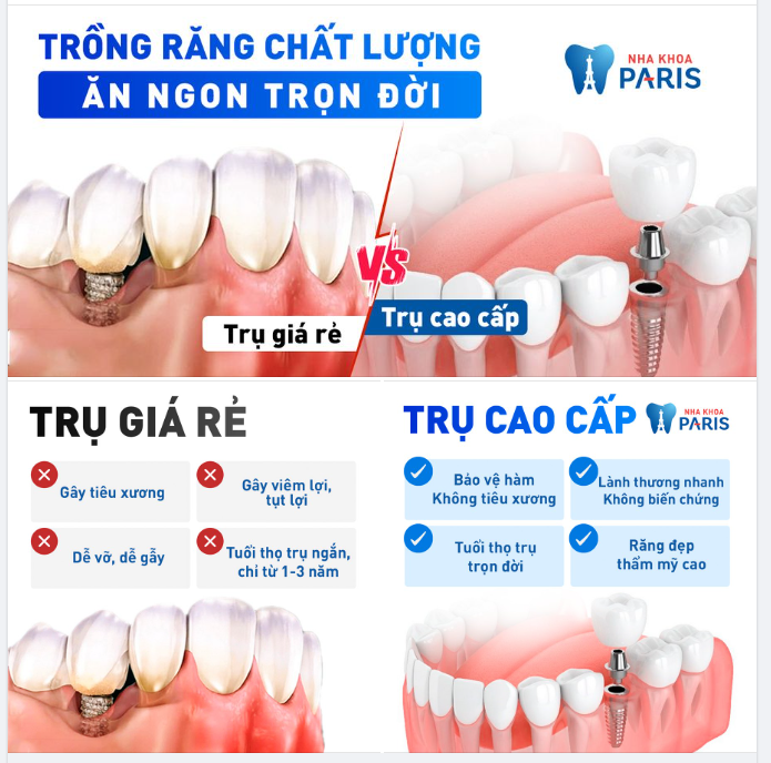 CẢNH BÁO TRỒNG RĂNG GIÁ RẺ RỦI RO KHÔN LƯỜNG