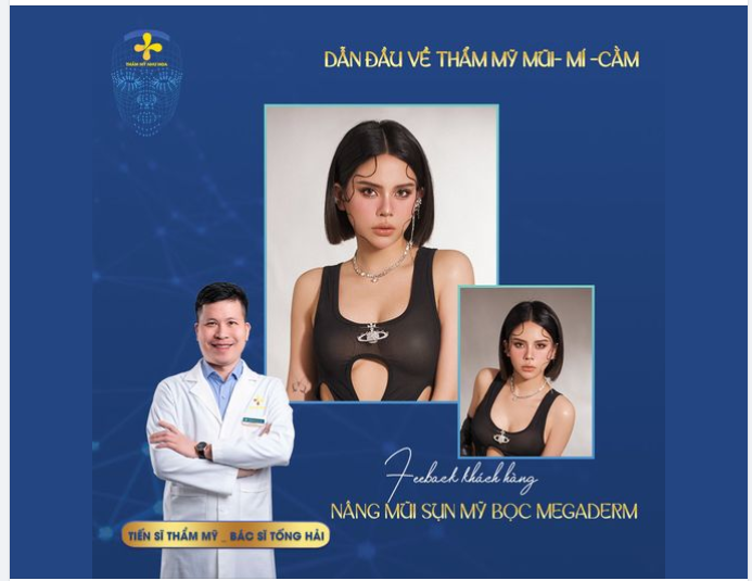 NÂNG MŨI ĐẸP NGAY – KHAI MỞ VẬN MAY