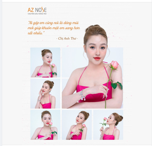 Review nhanh cuộc sống sau 1 năm nâng mũi!