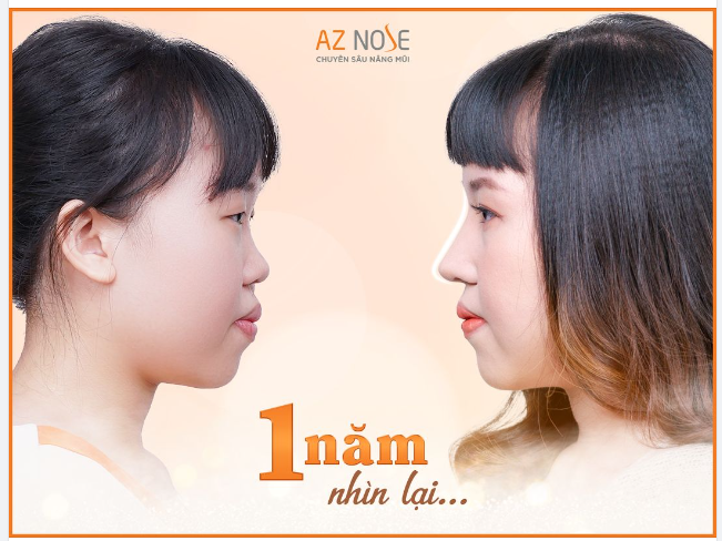 Hồi trước mình rụt rè lắm, nghe ai ch.ê b.ai ngoại hình cũng buồn, m.ặc cảm. Bây giờ thì khác rồi, diện mạo mới giúp mình có nhiều "tin vui" hơn như lập gia đình, có baby, và hay được mọi người khen xinh.", chị K.O chia sẻ về cuộc sống