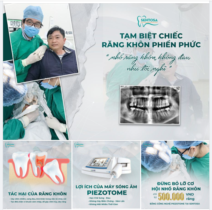 TẠM BIỆT CHIẾC RĂNG KHÔN PHIỀN PHỨC