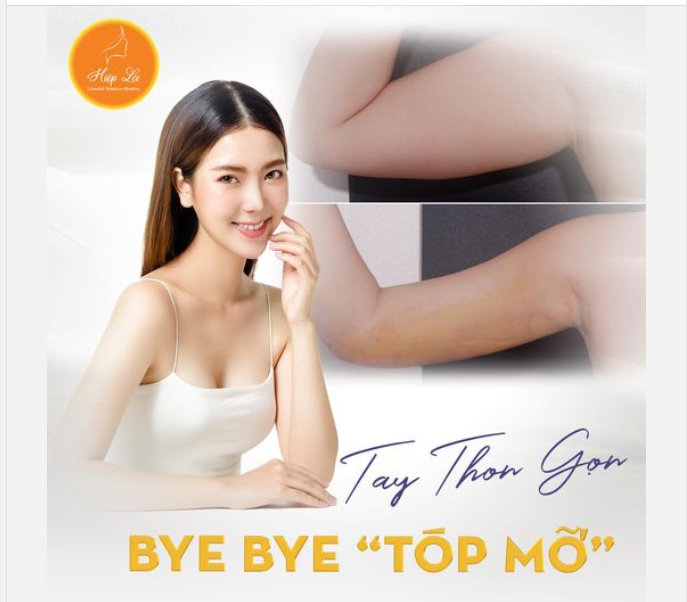 TAY THON GỌN - BYE BYE "TÓP MỠ"