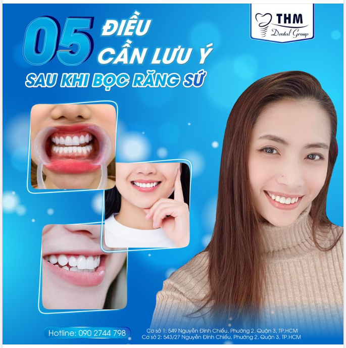 ĐIỀU CẦN LƯU Ý SAU KHI BỌC RĂNG SỨ THẨM MỸ