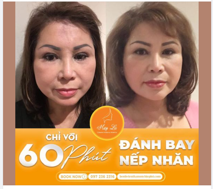 CHỈ VỚI 60P ĐÁNH BAY NẾP NHĂN