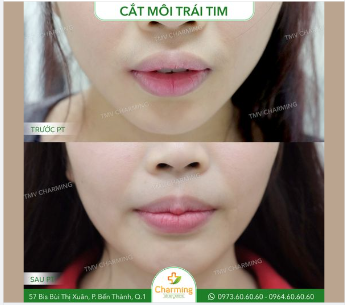 Đường cong môi cũng là một trong những đường cong quyến rũ của người phụ nữ.
