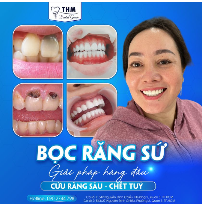 BỌC RĂNG SỨ - GIẢI PHÁP HÀNG ĐẦU GIẢI CỨU RĂNG SÂU, CHẾT TỦY