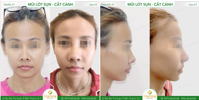 Một khuôn mặt đẹp cần có sự cải thiện tinh tế nhất.