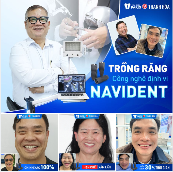 Chỉ 3 ngày lấy lại răng mất, ăn ngon vui khỏe với công nghệ cấy ghép Implant định vị Navident