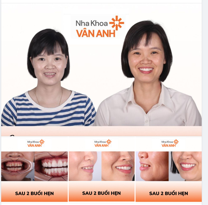 Duy trì vẻ rạng rỡ như tuổi đôi mươi với nụ cười tỏa sáng