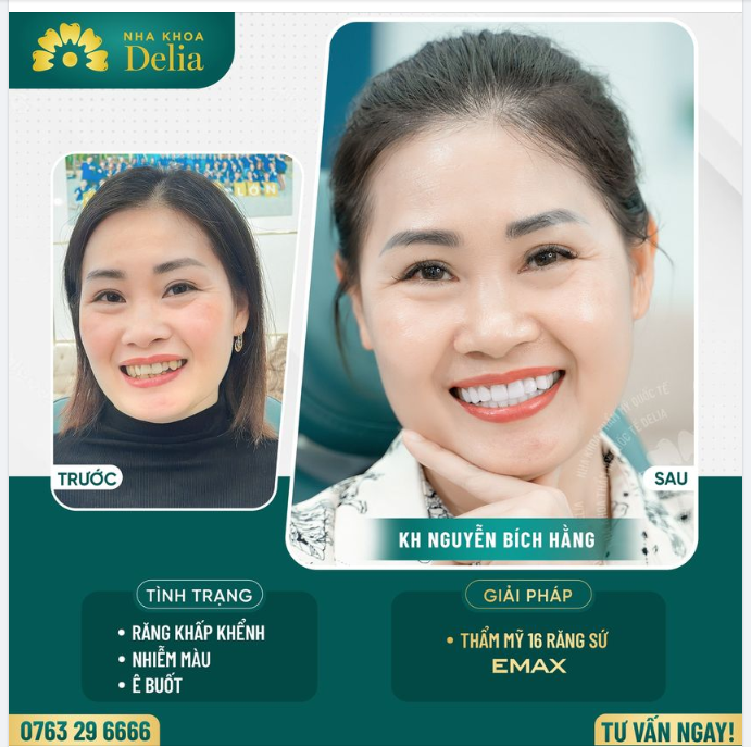 Kiến tạo nụ cười đều đẹp - sáng khoẻ