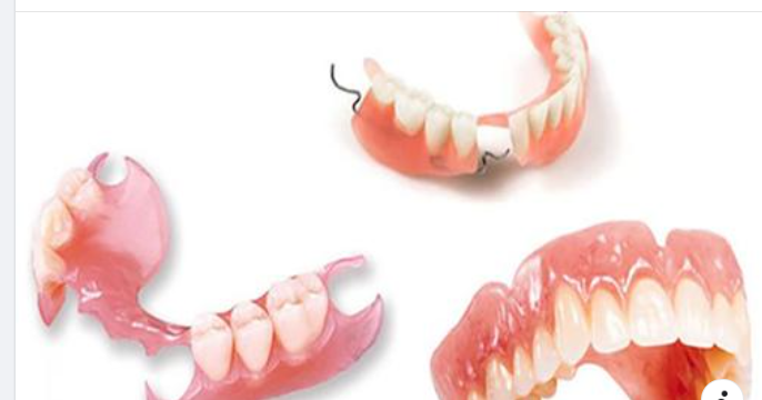 Ưu Nhược Điểm Của Hàm Giả Tháo Lắp